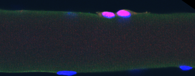 Muskelstammzellen auf einer Muskelfaser (Pax7 – Marker für Muskelstammzellen in rot, Dapi in blau)